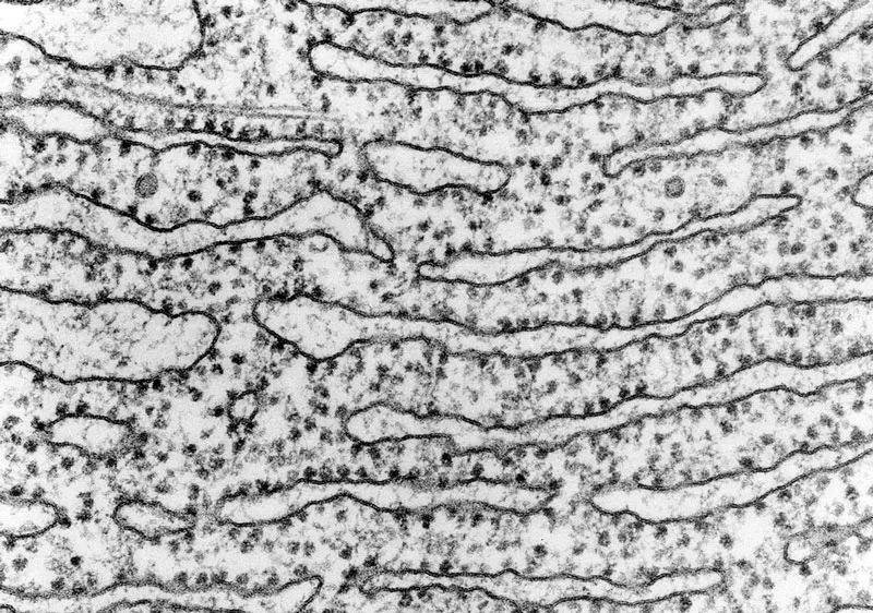 Ribosomas y endomembranas