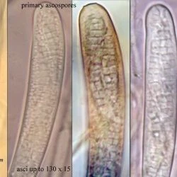 Fotografía Claussenomyces atrovirens (Pers.) Korf & Abawi (1 de 3)