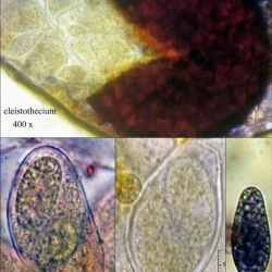 Fotografía Golovinomyces cichoracearum DC. (1 de 3)