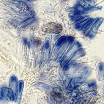 Thalloidima candidum (Weber) A.Massal. (5 de 6)