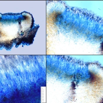 Thalloidima candidum (Weber) A.Massal. (4 de 6)