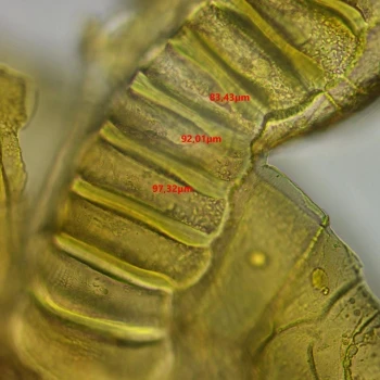 Polypodium interjectum (5 de 5)