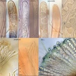 Fotografía Claussenomyces atrovirens (Pers.) Korf & Abawi (2 de 3)